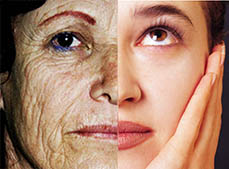 Exoderm peel chemical peels